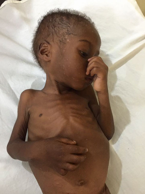 nigerian-starving-thirsty-boy-hope-rescued-anja-ringgren-loven-26